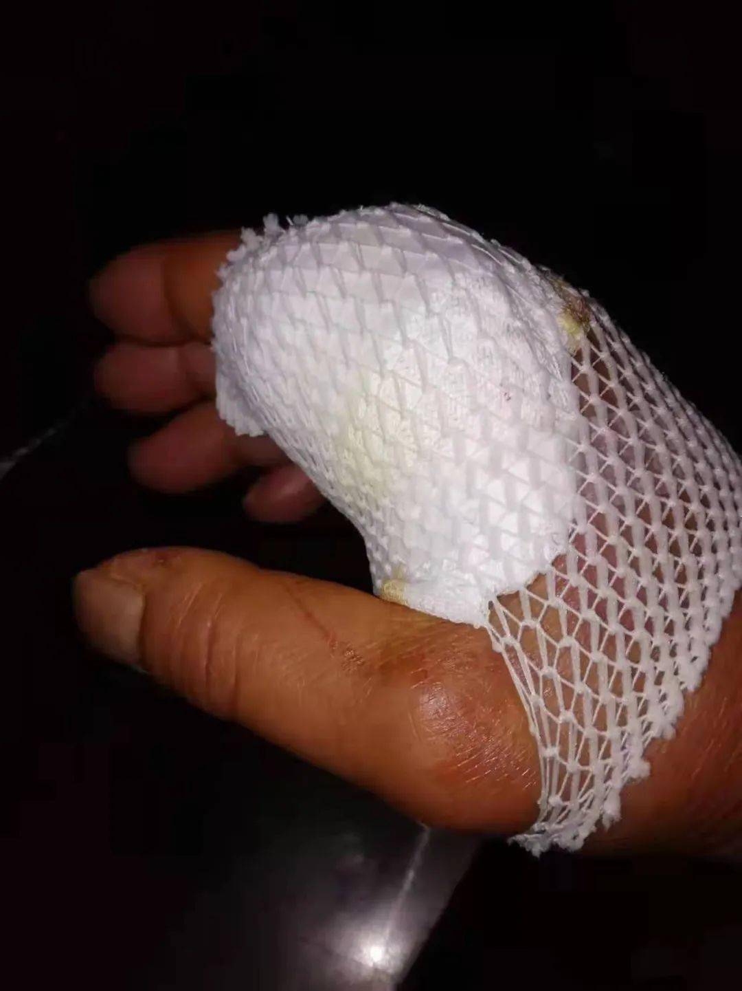 开云体育APP下载-福建泉州队员因伤退出球队,伤情严重